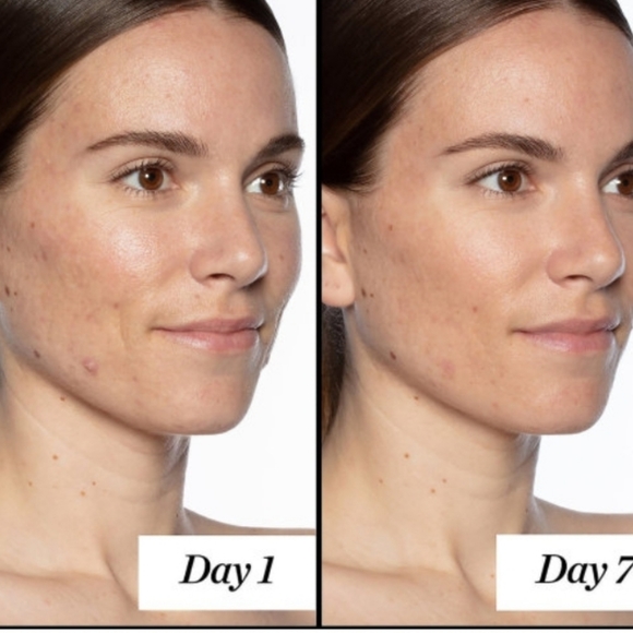 Luna Retinol sleeping night oil.0.5 oz new in box - Picture 11 of 12